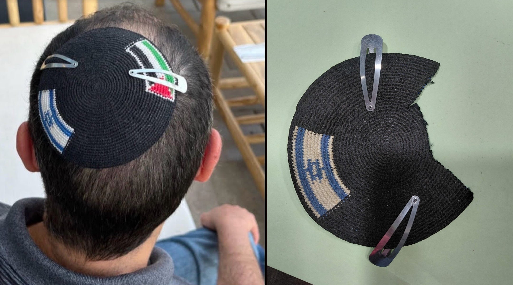His kippah was a symbol of coexistence. Israeli police officers seized and destroyed it.