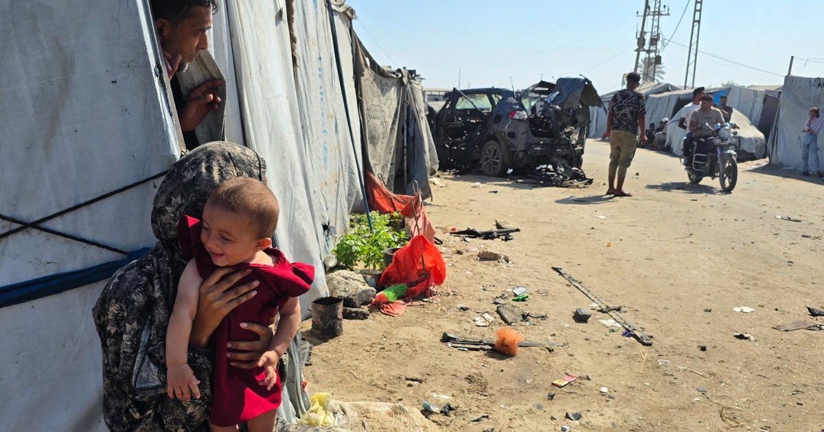 UN reports severe chickenpox outbreak in Gaza Strip as displaced Palestinians crowd in tent cities