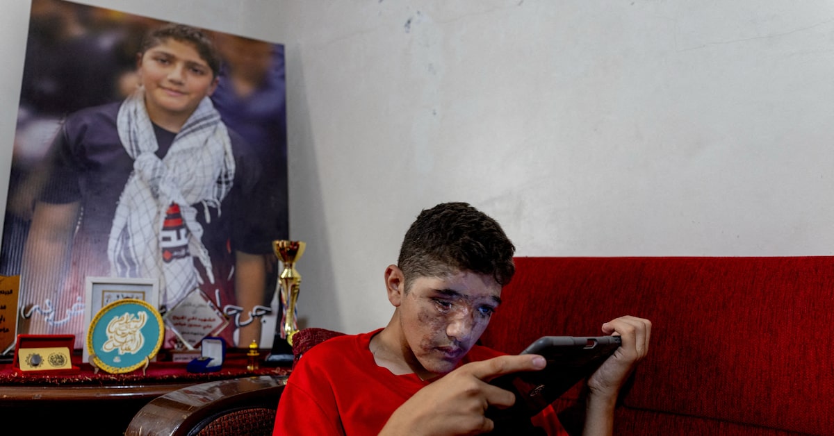 Two years after Israel’s pager attacks in Lebanon against Hezbollah militants, teenage survivor rebuilds his life