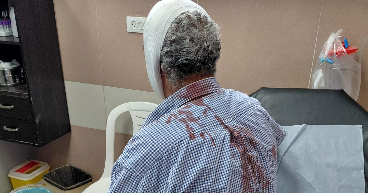 West Bank settlers attack Palestinians in series of weekend incidents