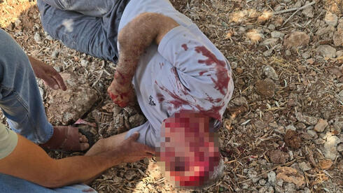 Anti-Zionist terrorism is hurting Israel from within — and the world is watching
